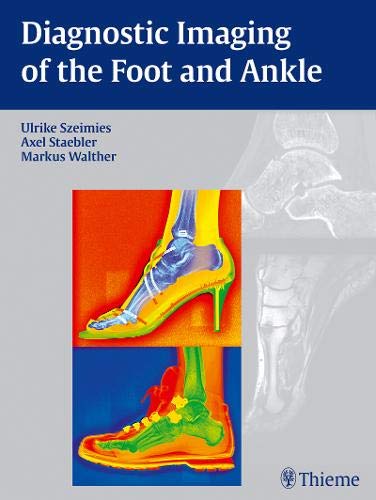 exclusive-publishers/thieme-medical-publishers/diagnostic-imaging-of-the-foot-and-ankle-9783131764614
