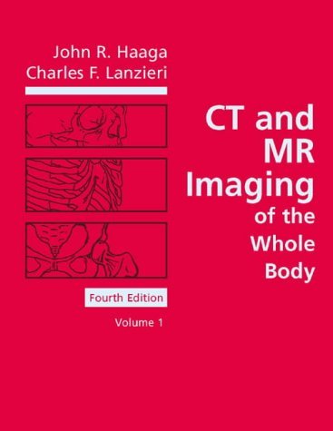 medical/radiology/ct-and-mr-imagingof-the-whole-body-2-vol-set-9780323011334