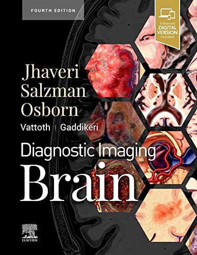 medical/radiology/diagnostic-imaging-brain-4e-9780323756204