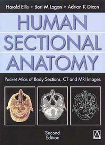 special-offer/special-offer/human-sectional-anatomy-2ed---9780340807644