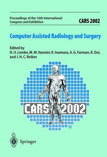 

clinical-sciences/radiology/proceedings-of-the-16th-international-congress-exhibition-cars-2002-computer-assisted-radiology--9783540436553