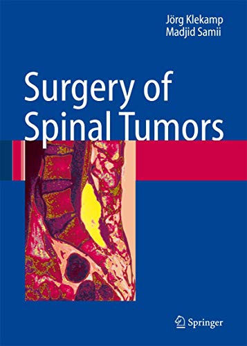 

surgical-sciences/nephrology/surgery-of-spinal-tumours-9783540447146