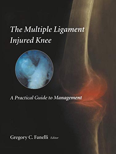 medical/orthopaedics/the-multiple-ligament-injured-knee-a-practical-guide-to-management-9780387405483