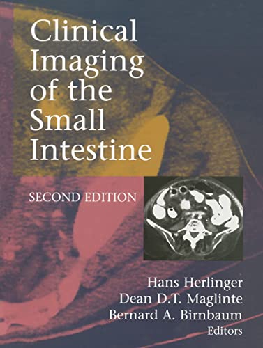 medical/radiology/clinical-imaging-of-the-small-intestine-9780387985169