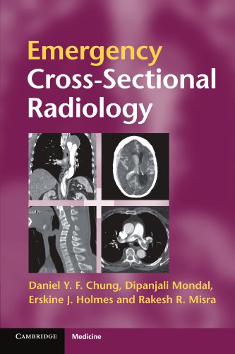 exclusive-publishers/cambridge-university-press/emergency-cross-sectional-radiology-9780521279536