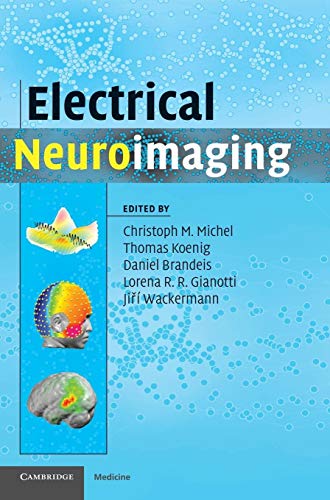 medical/radiology/electrical-neuroimaging-9780521879798