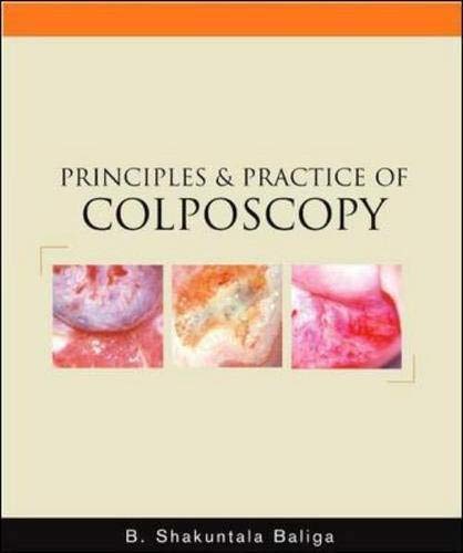 
PRINCIPLES AND PRACTICE OF COLPOSCOPY