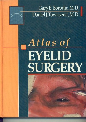 medical/surgery/-old-atlas-of-eyelid-surgery-9780721636405