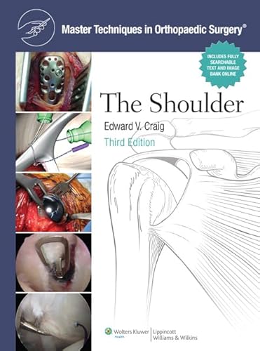 medical/surgery/master-techniques-in-orthopaedic-surgery-the-shoulder-3-ed-9780781797481