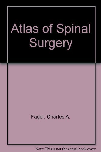 special-offer/special-offer/atlas-of-spinal-surgery--9780812111729