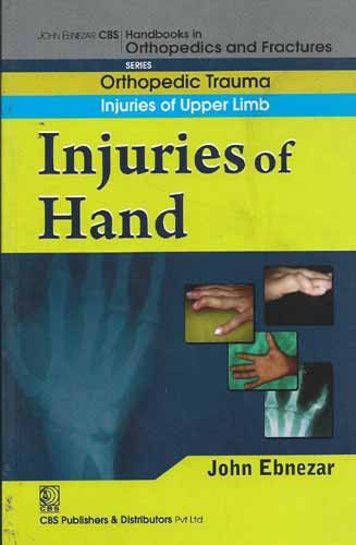 INJURIES OF HAND (HANDBOOKS IN ORTHOPEDICS AND FRACTURES SERIES VOL 11 ORTHOPEDIC TRAUMA INJURIES OF UPPER LIMB (2012)- ISBN: 9788123920849