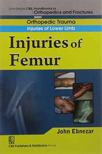 
best-sellers/cbs/in-juries-of-femur-handbook-in-orthopedics-and-fractures-vol-14-orthopedic-trauma-injuries-of-lower-limb-2012--9788123920870