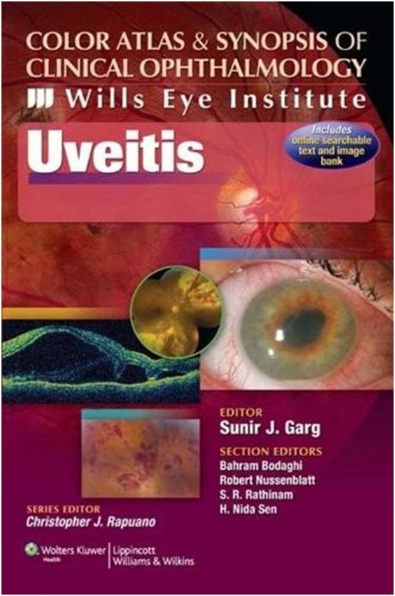 
color-atlas-synopsis-of-clinical-ophthalmology---uveitis-1-ed-9788184737226