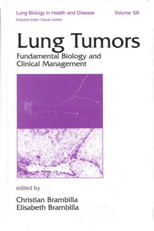 special-offer/special-offer/lung-biology-in-health-and-disease-vol-124-lung-tumors--9780824701604