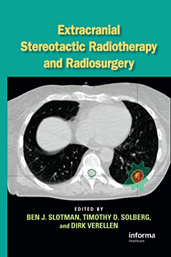 medical/oncology/extracranial-stereotactic-radiotherapy-and-radiosurgery-9780824726973