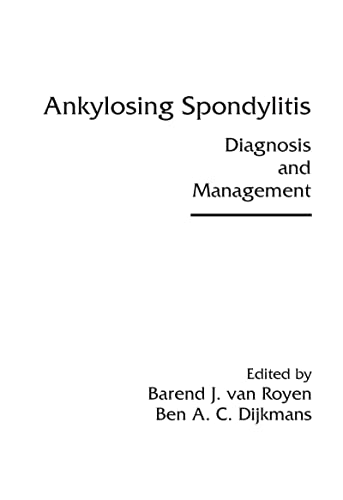 special-offer/special-offer/ankylosing-spondylitis-diangosis-and-management--9780824727512