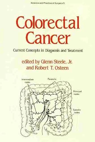 special-offer/special-offer/colorectal-cancer-current-concepts-in-diagnosis-and-treatment-science-practice-of-surgery--9780824773724