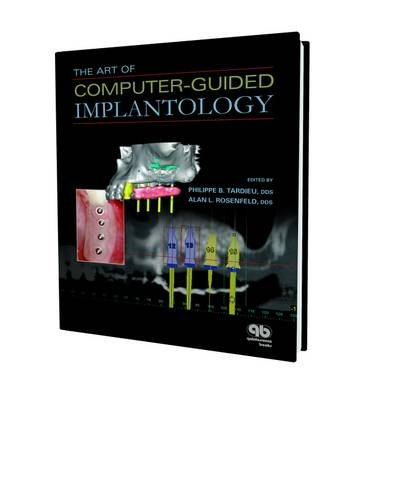 technical//the-art-of-computer---guided-implantology-9780867154771