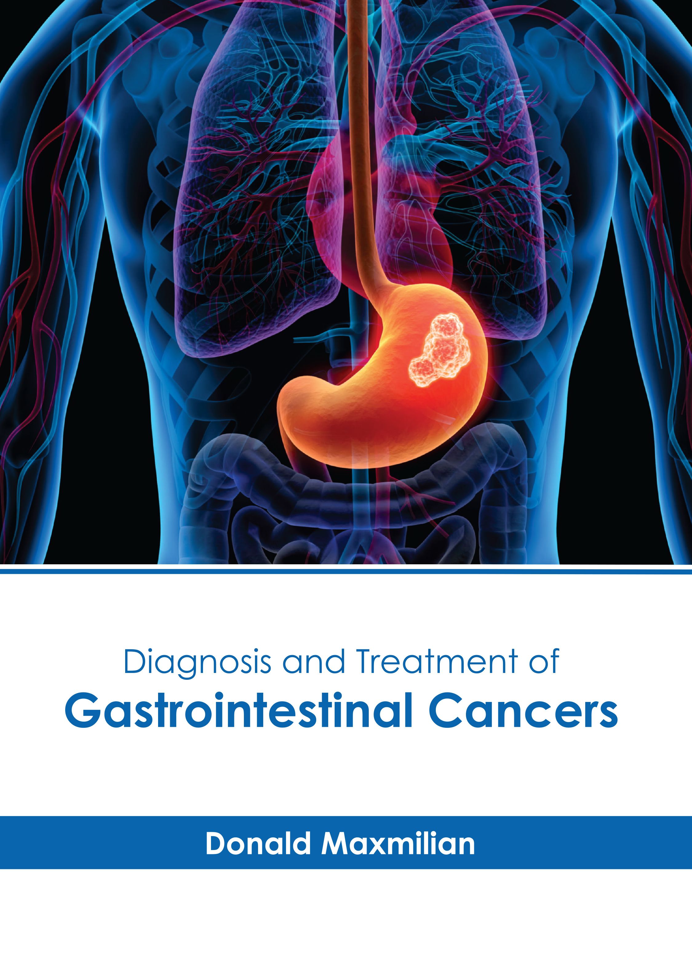DIAGNOSIS AND TREATMENT OF GASTROINTESTINAL CANCERS