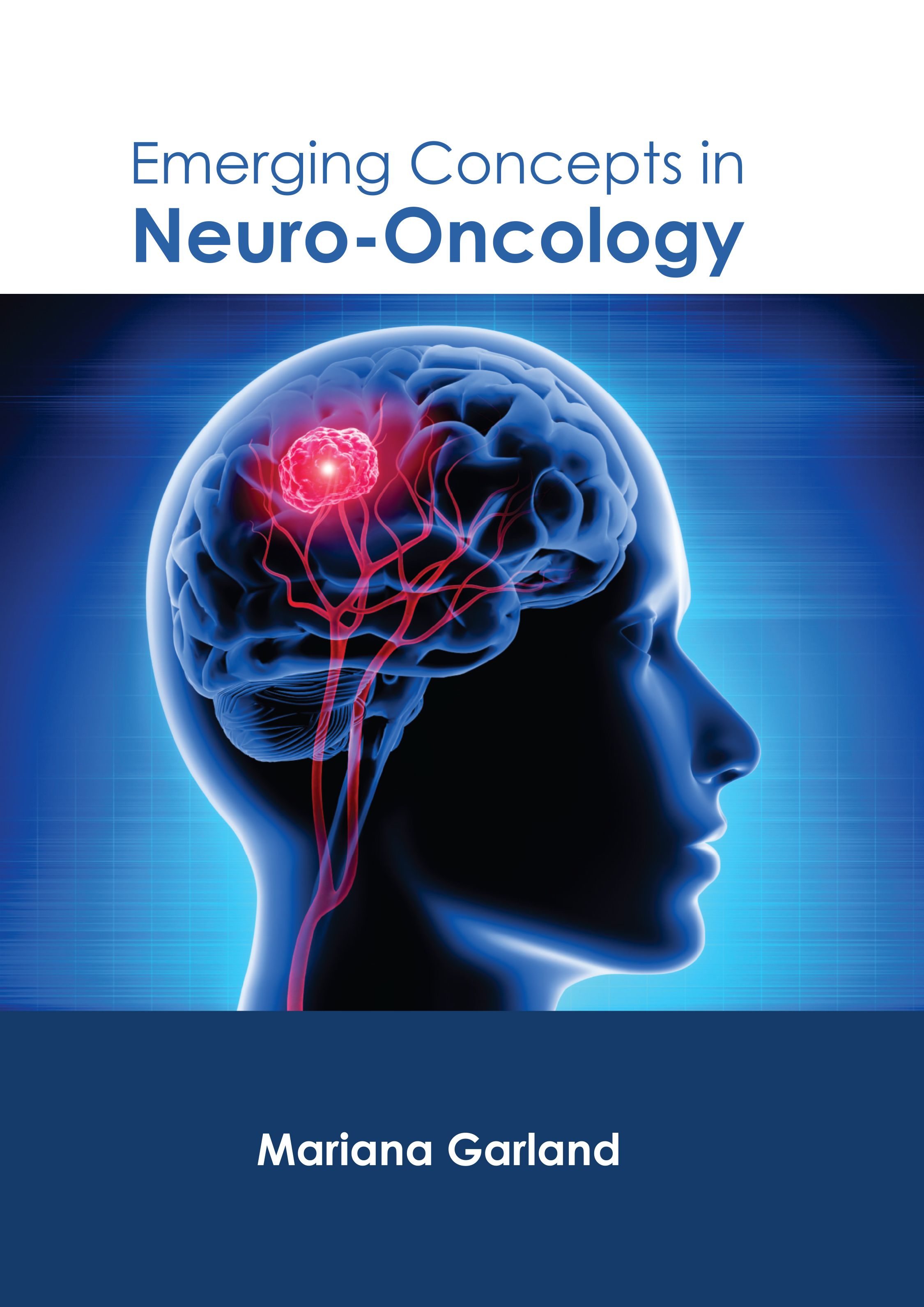 EMERGING CONCEPTS IN NEURO-ONCOLOGY