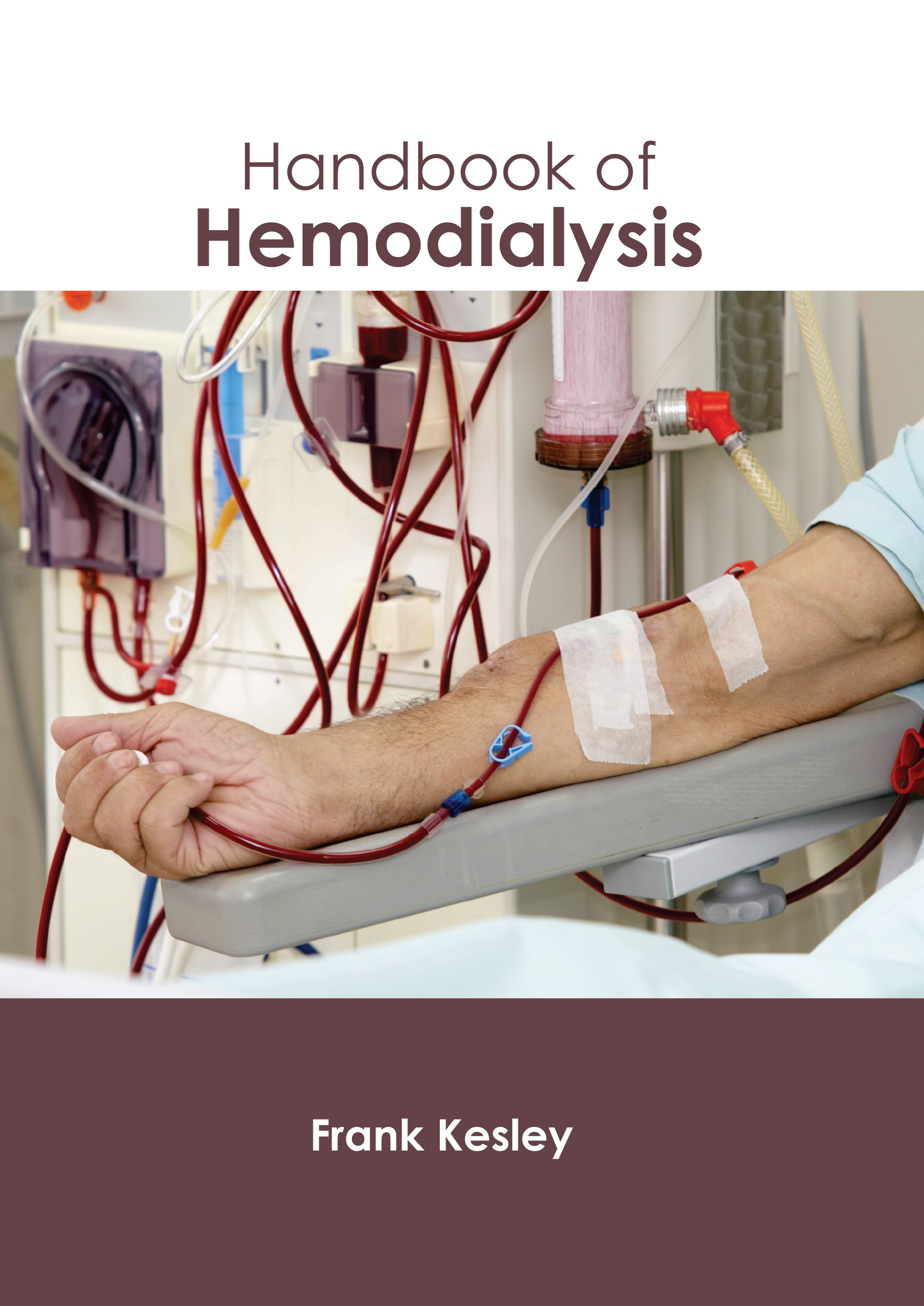 HANDBOOK OF HEMODIALYSIS
