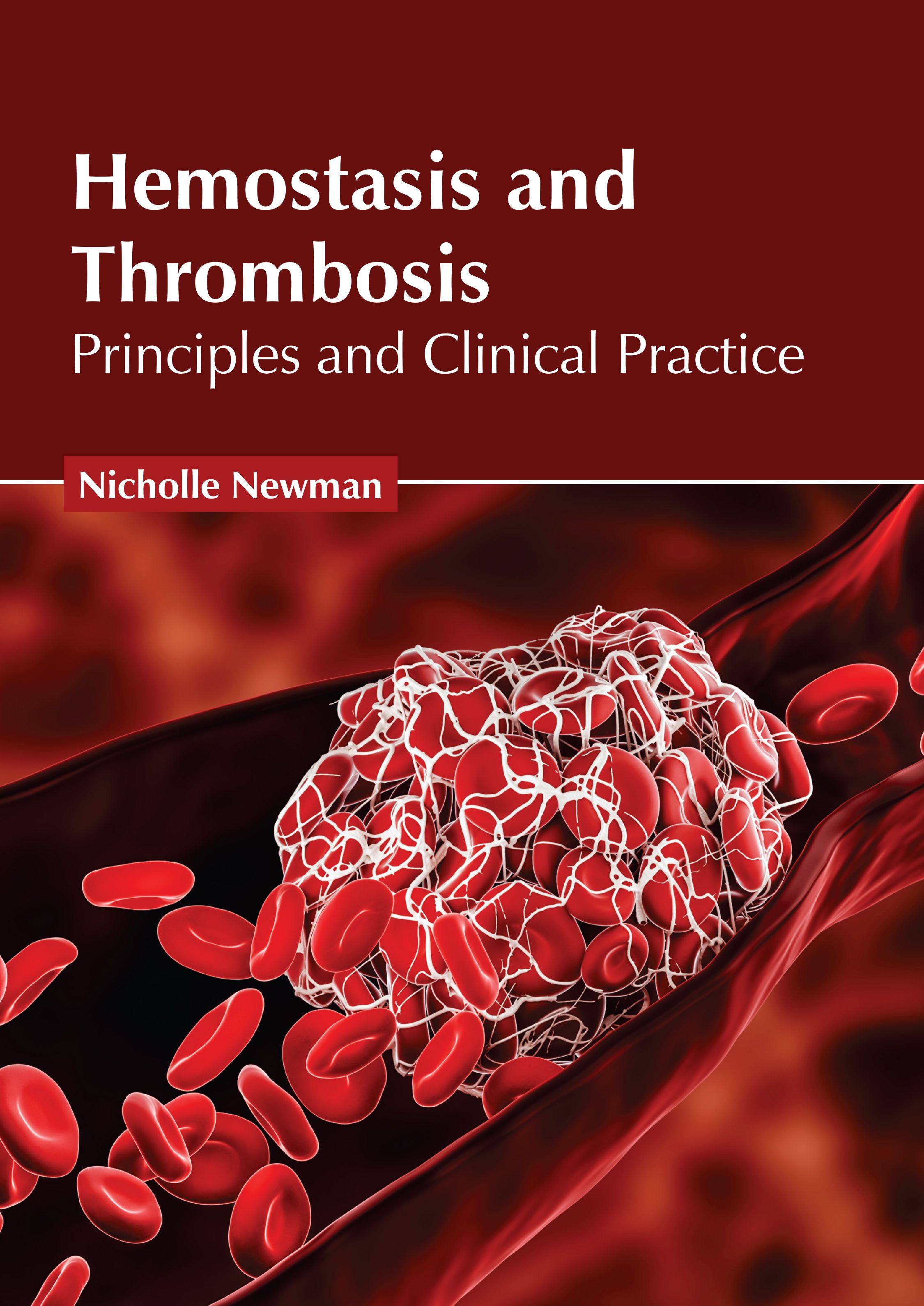 HEMOSTASIS AND THROMBOSIS: PRINCIPLES AND CLINICAL PRACTICE