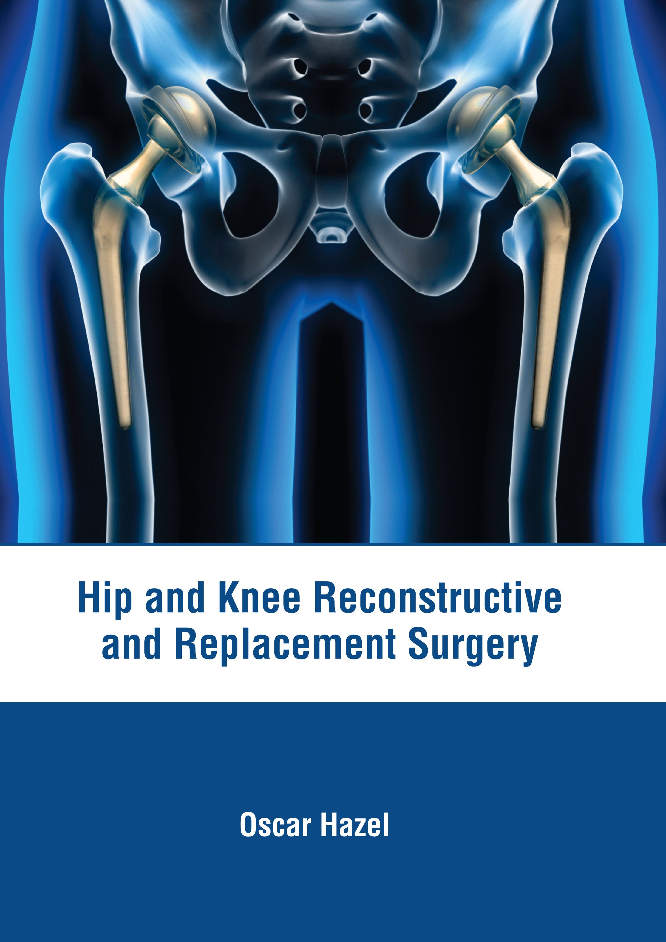 HIP AND KNEE RECONSTRUCTIVE AND REPLACEMENT SURGERY