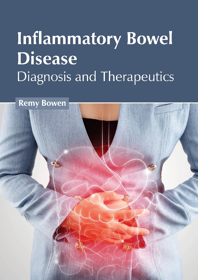 INFLAMMATORY BOWEL DISEASE: DIAGNOSIS AND THERAPEUTICS