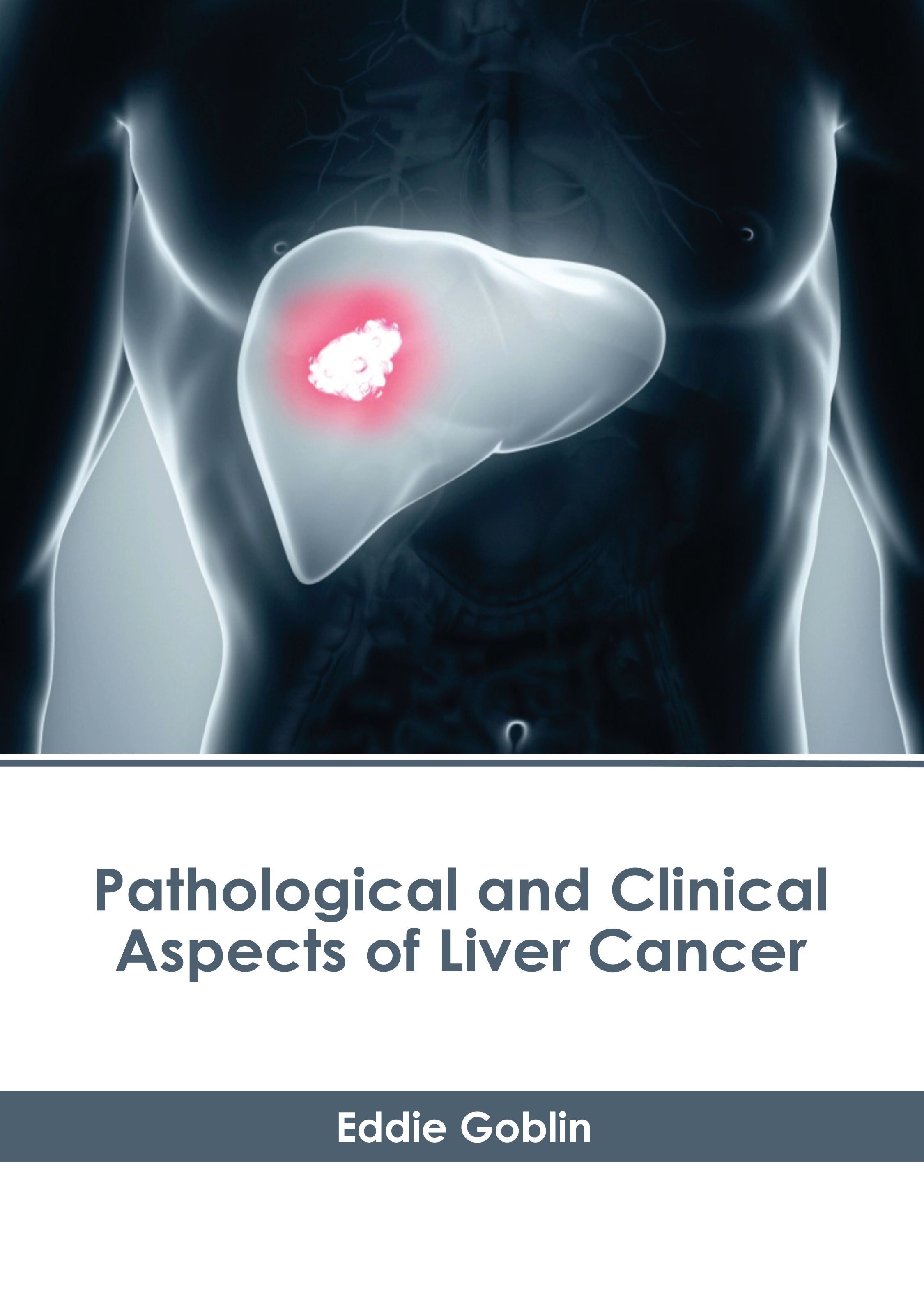 PATHOLOGICAL AND CLINICAL ASPECTS OF LIVER CANCER