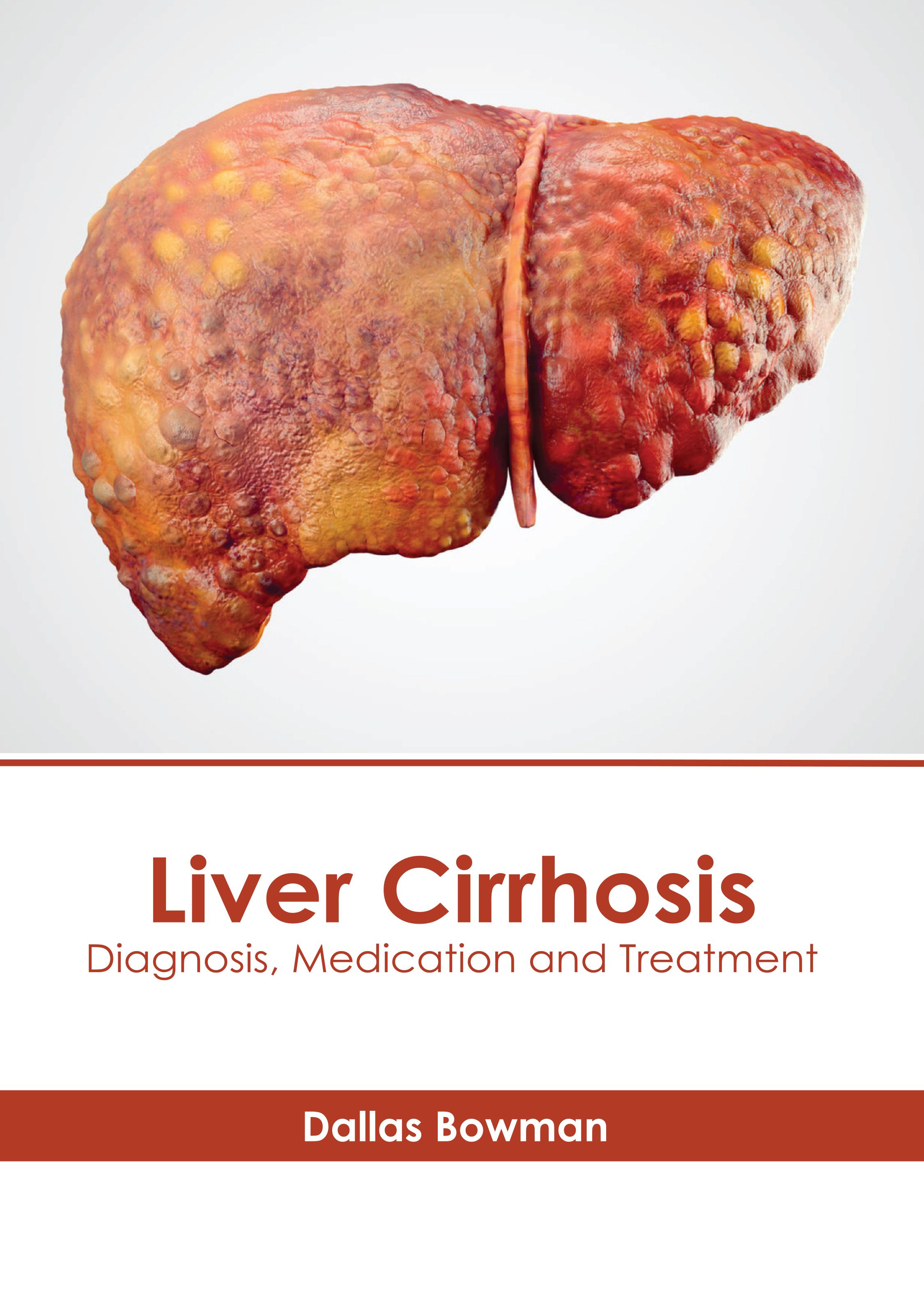 LIVER CIRRHOSIS: DIAGNOSIS, MEDICATION AND TREATMENT