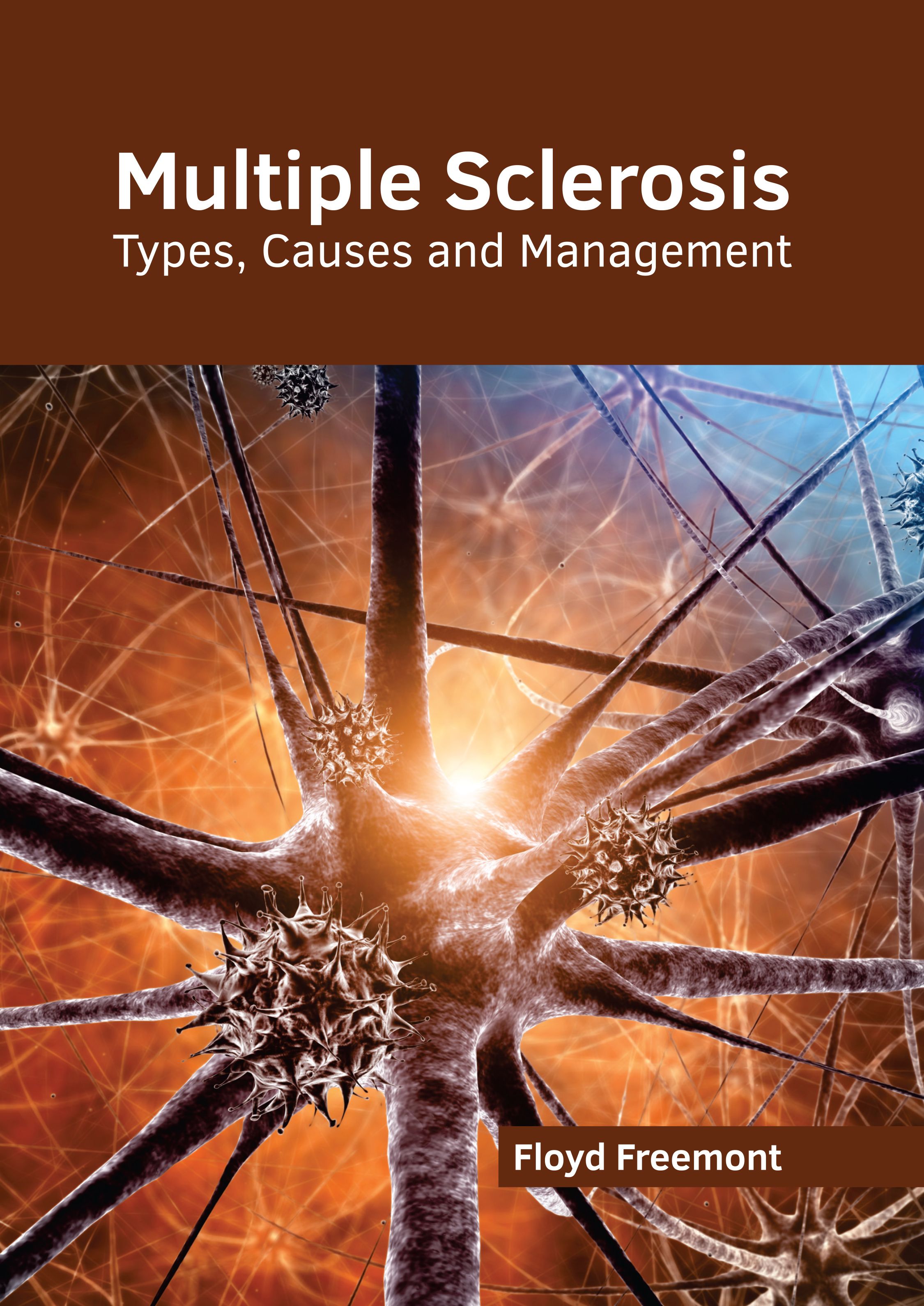 MULTIPLE SCLEROSIS: TYPES, CAUSES AND MANAGEMENT