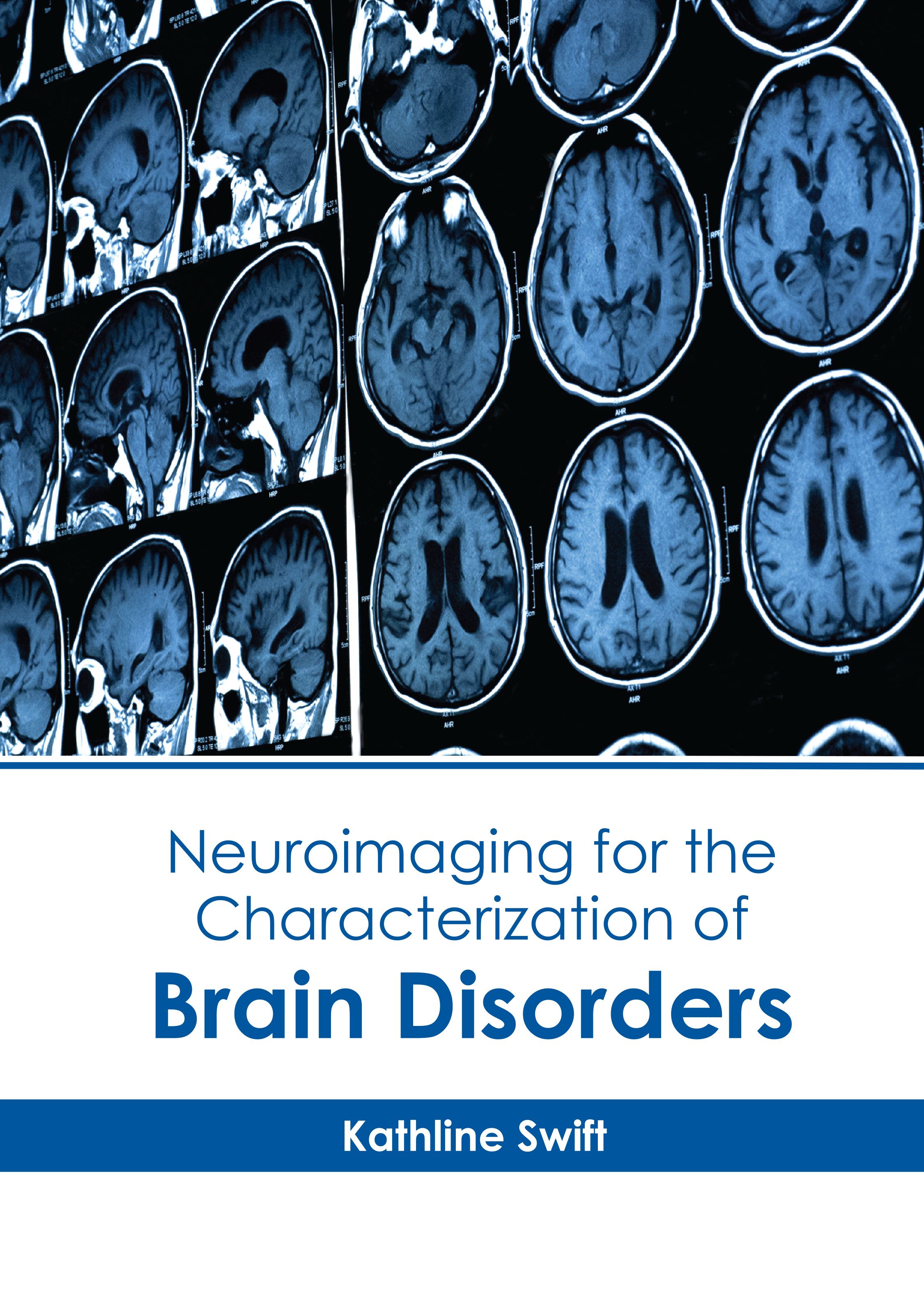 NEUROIMAGING FOR THE CHARACTERIZATION OF BRAIN DISORDERS
