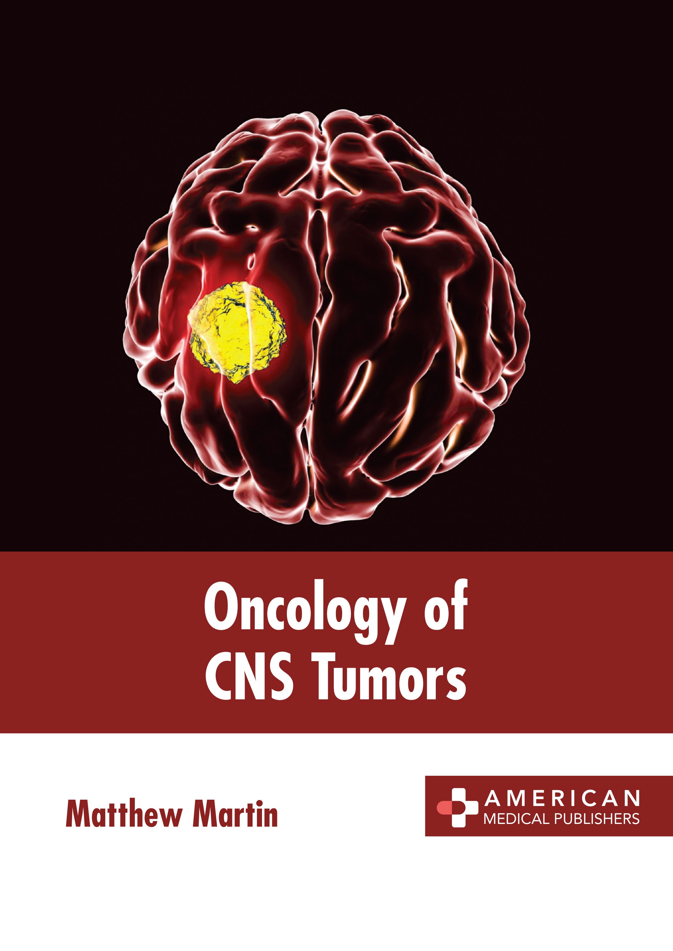 ONCOLOGY OF CNS TUMORS