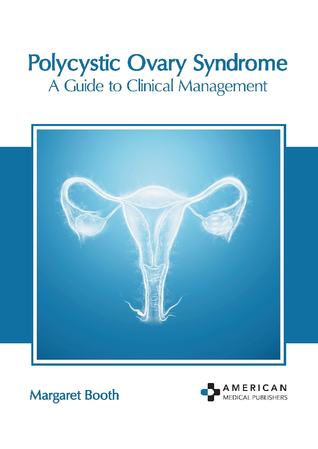 POLYCYSTIC OVARY SYNDROME: A GUIDE TO CLINICAL MANAGEMENT