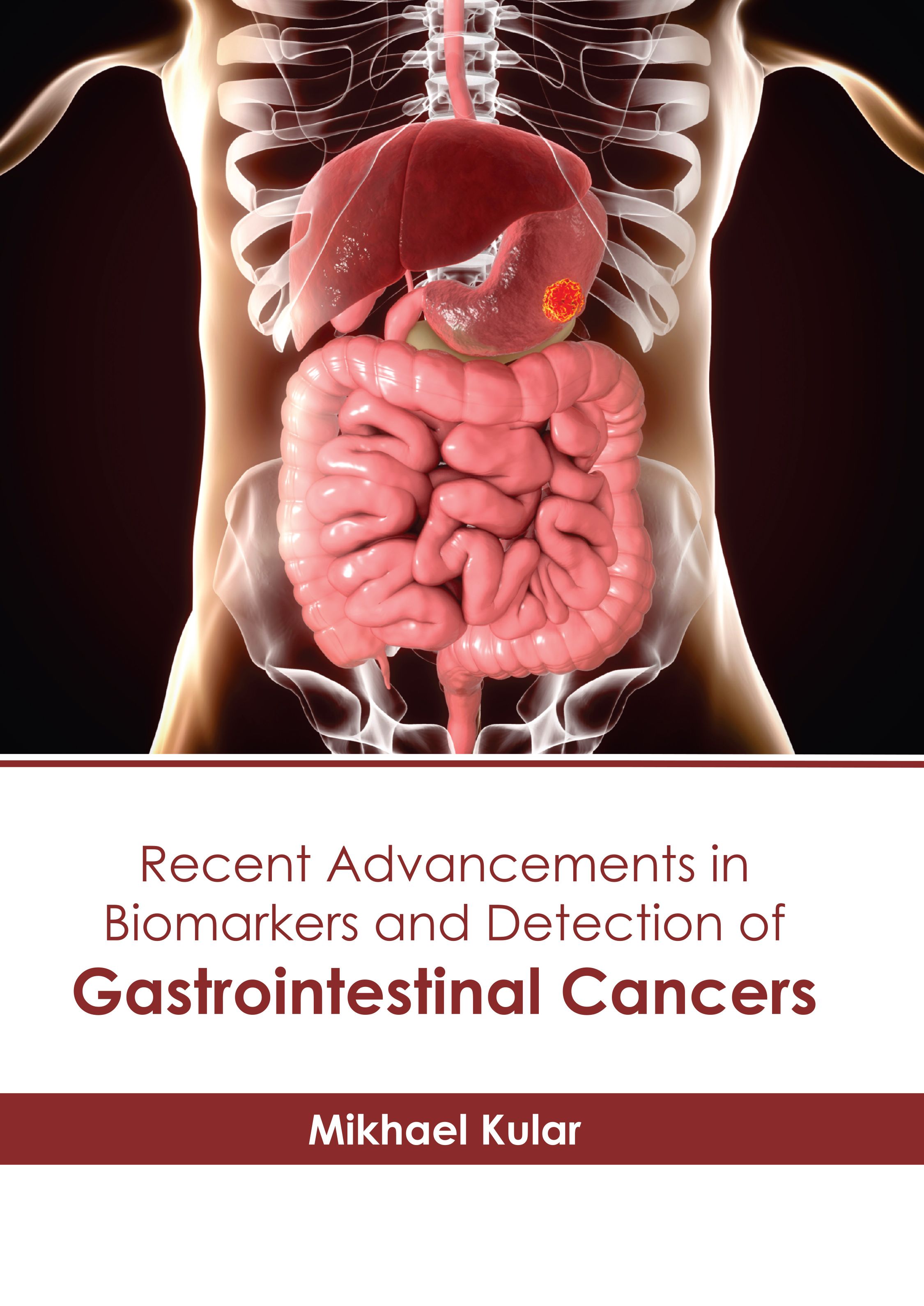 RECENT ADVANCEMENTS IN BIOMARKERS AND DETECTION OF GASTROINTESTINAL CANCERS