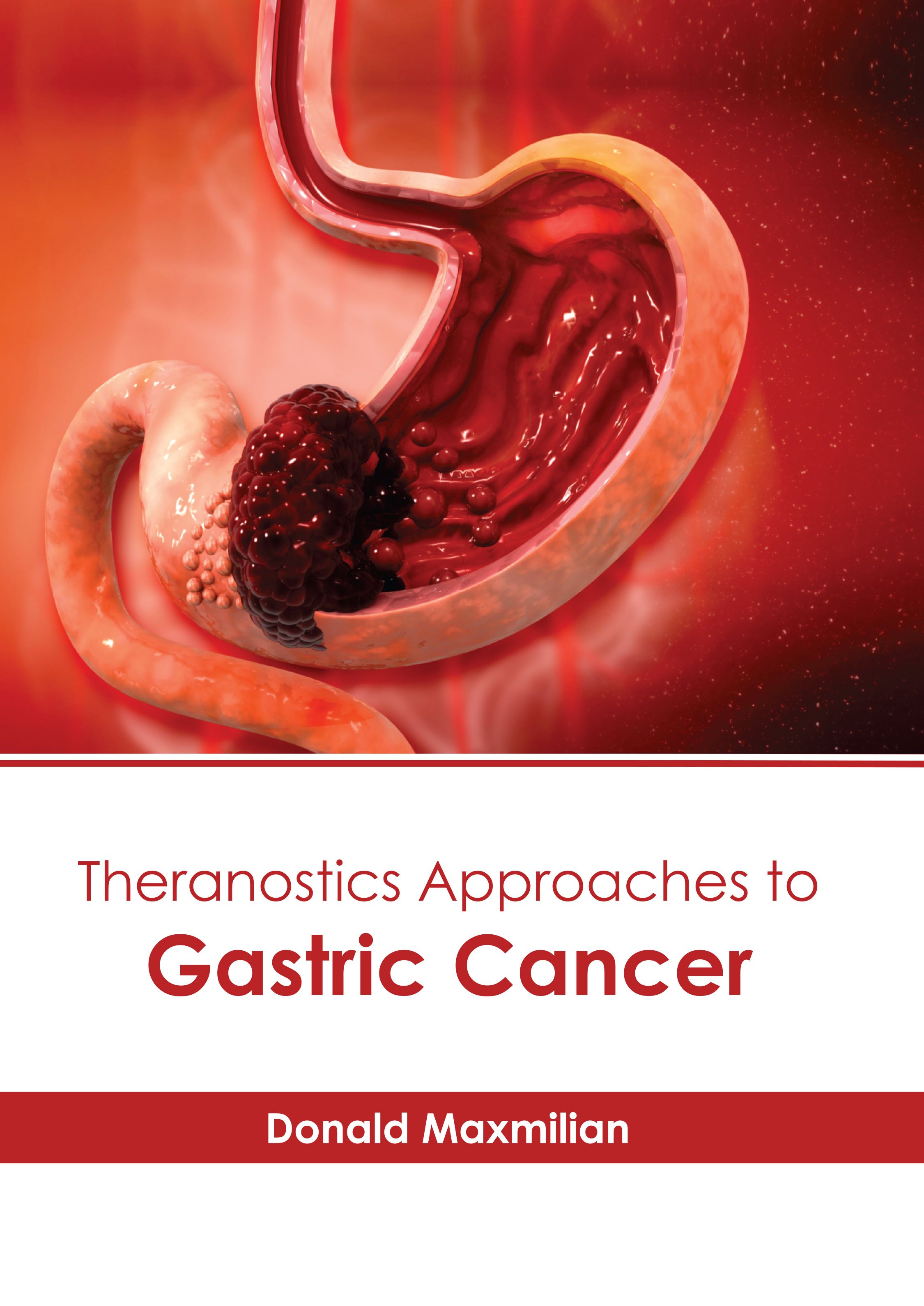THERANOSTICS APPROACHES TO GASTRIC CANCER