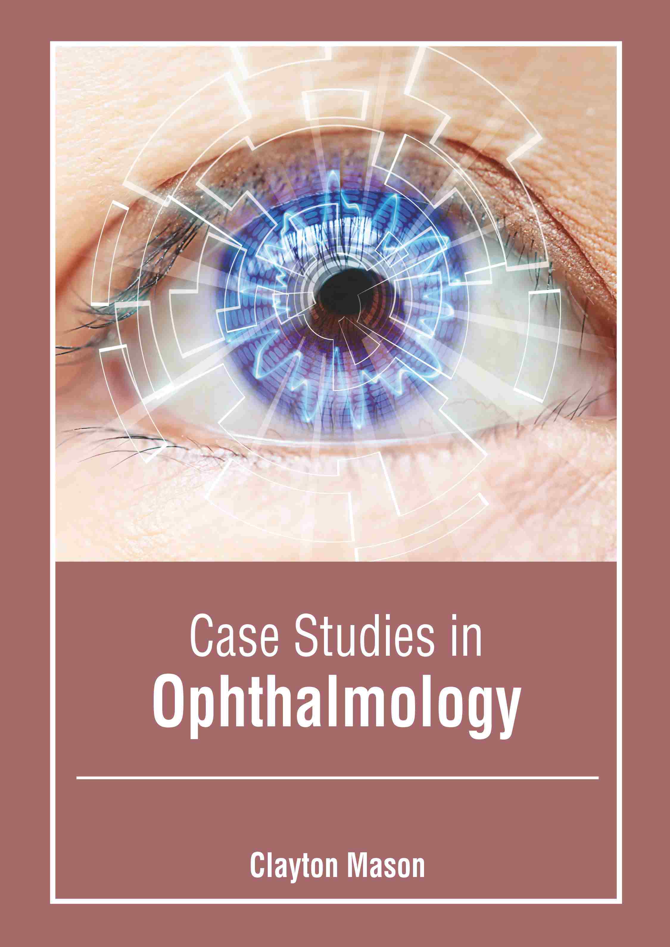 exclusive-publishers/american-medical-publishers/case-studies-in-ophthalmology-9798887406213
