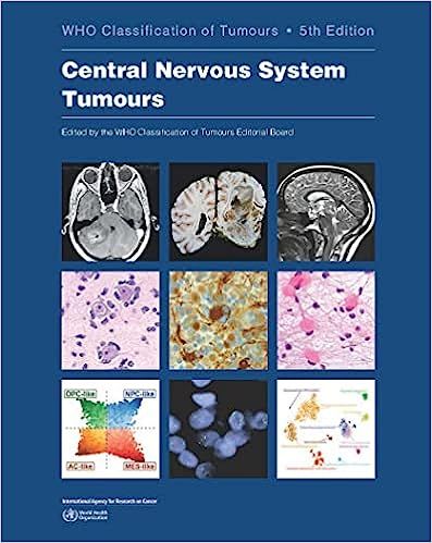 WHO CLASSIFICATION OF TUMOURS OF THE CENTRAL NERVOUS SYSTEM VOL-6