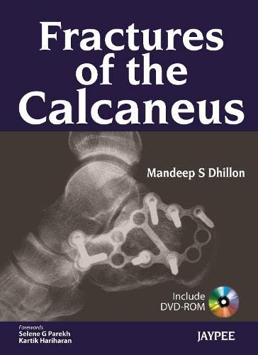 best-sellers/jaypee-brothers-medical-publishers/fractures-of-the-calcaneus-with-dvd-rom-9789350903438