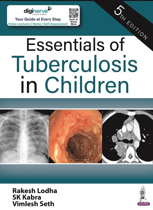 ESSENTIALS OF TUBERCULOSIS IN CHILDREN- ISBN: 9789354657627