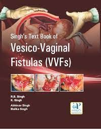SINGH'S TEXT BOOK OF VESICO-VAGINAL FISTULAS (VVFS)
