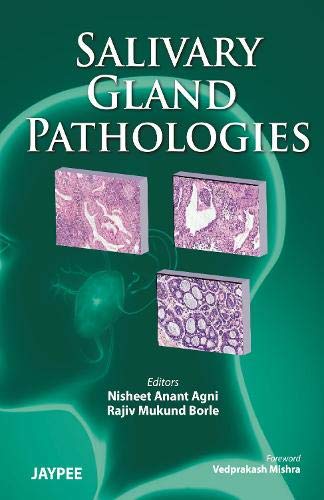 
best-sellers/jaypee-brothers-medical-publishers/salivary-gland-pathologies-9789380704722