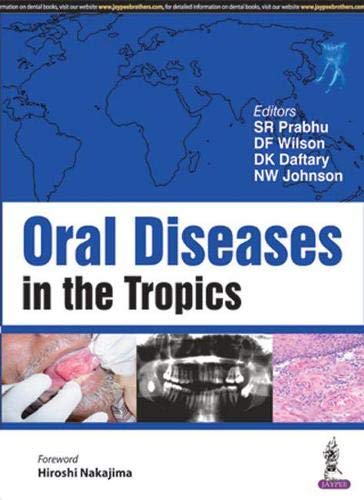 
best-sellers/jaypee-brothers-medical-publishers/oral-diseases-in-the-tropics-9789386150554
