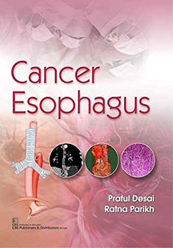 
best-sellers/cbs/cancer-esophagus-pb-2020--9789389261837