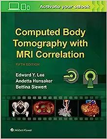 COMPUTED BODY TOMOGRAPHY WITH MRI CORRELATION