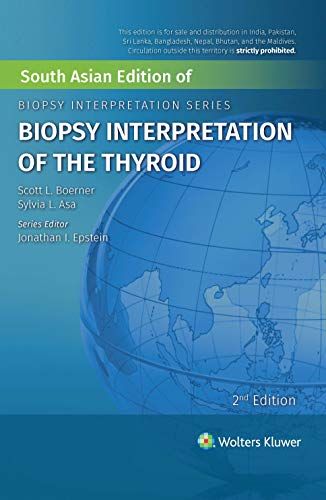 BIOPSY INTERPRETATION OF THE THYROID