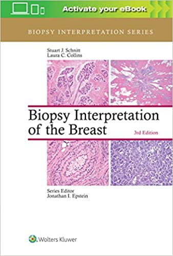 Biopsy Interpretation Of The Breast, 3/ED