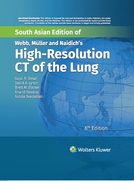 Webb, Müller And Naidich'S High-Resolution Ct Of The Lung 6/ED